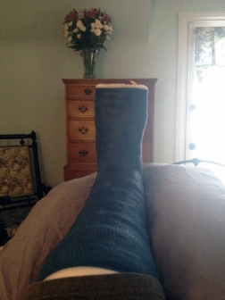 My left foot, 24-hours after breaking bad.